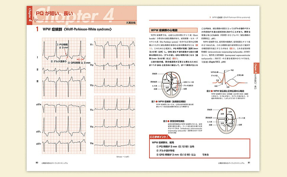 楽天ブックス: 心電図の読み方パーフェクトマニュアル - 理論と