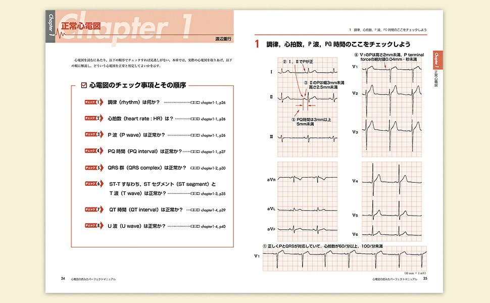 心電図検定 心電図の読み方パーフェクトマニュアル 1・2級心電図完全攻略 羊土社 心電図の読み方パーフェクトマニュアル―理論と波形パターンで