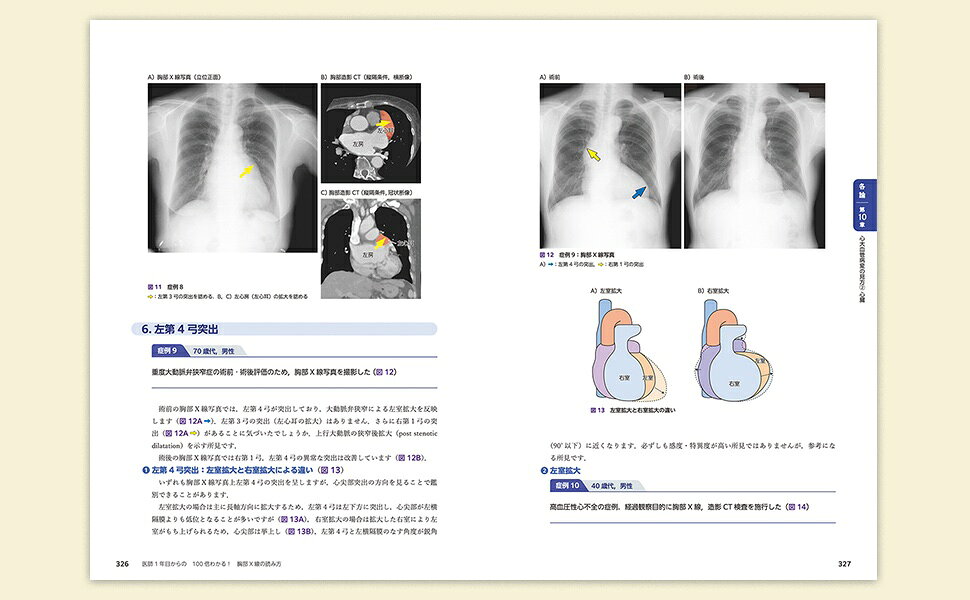 DVD 3D画像を動かして学ぶ胸部の解剖とX線写真の読影 - 株式会社