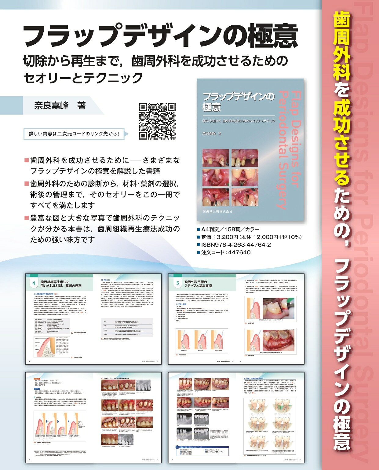 楽天ブックス: フラップデザインの極意 - 切除から再生まで，歯周外科