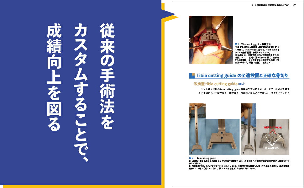 楽天ブックス: 誰も教えてくれなかった足の外科［Web動画付］ - NIKI