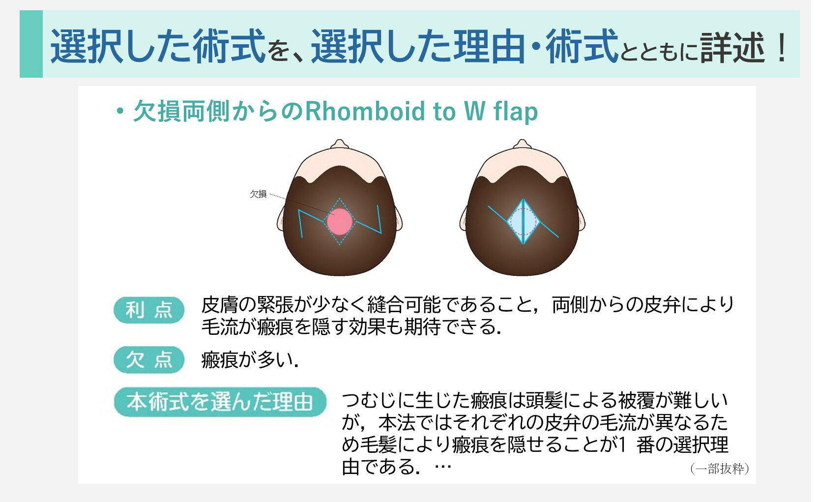 楽天ブックス: 局所皮弁塾 - あなたならこの顔の欠損をどう治す？ - 四