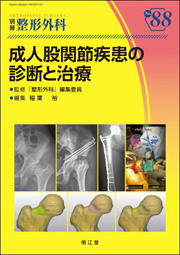 楽天ブックス: 最小侵襲アプローチで究めるTHA・BHA - トップ
